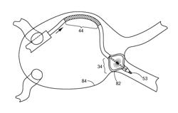 Multifunctional ablation device