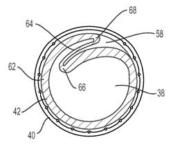 Expandable sheath