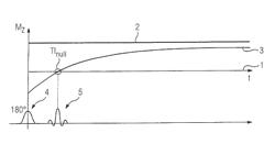 Method and apparatus for recording magnetic resonance data