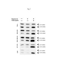 Peptide for targeting autophagic cells and use thereof