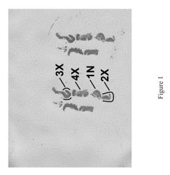 METHODS FOR TREATING BARRETT'S METAPLASIA AND ESOPHAGEAL ADENOCARCINOMA