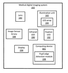 Pupil Edge Detection in Digital Imaging