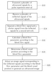 ULTRASOUND IMAGING METHOD