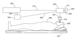 LASER METHODS AND SYSTEMS FOR ADDRESSING, MITIGATING AND REVERSING PRESBYOPIA