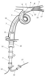 Devices and methods for removal of acute blockages from blood vessels