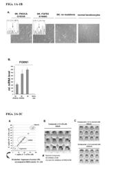 Agents and methods for treating and preventing seborrheic keratosis