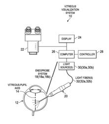 ILLUMINATING OPHTHALMIC ENDOPROBE