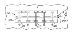 Surgical incision and closure apparatus