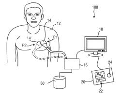 ULTRASOUND IMAGING SYSTEM AND METHOD