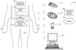 AUTOMATIC ANALYTE SENSOR CALIBRATION AND ERROR DETECTION