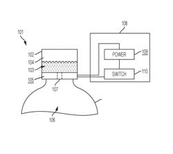 Closure device