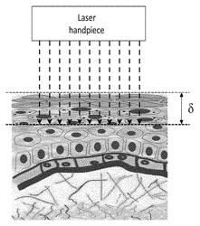 Apparatus and method for tissue regeneration