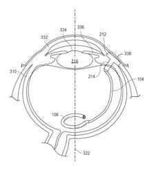 Small molecule transport device with anti-condensation filler for drug delivery or waste removal