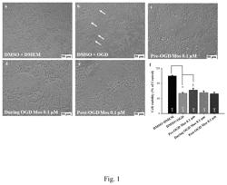 Method for treating developmental retinal vascular disorder