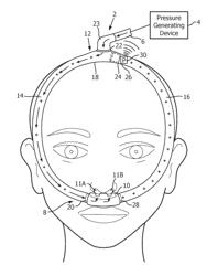 Headgear tubing assembly and integrated pressure sensing