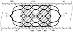 VASCULAR OCCLUSION DEVICE