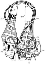 WEARABLE MODULAR EXTRACORPOREAL LIFE SUPPORT DEVICE FOR MOBILE TREATMENT OF SINGLE AND MULTIORGAN FAILURE