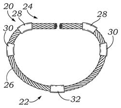 Flexible annuloplasty ring with select control points