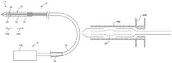 Stent-valve, delivery apparatus and method of use