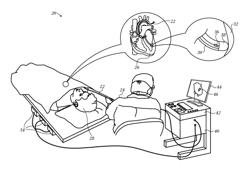 Integrated assessment of electrical activation and myocardial strain