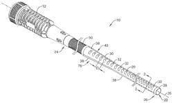 Introducer with expandable capabilities