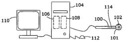 SYSTEMS AND METHODS FOR TREATING CARDIAC ARRHYTHMIA