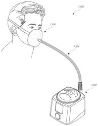 DISTINGUISHING BETWEEN CENTRAL AND OBSTRUCTIVE SLEEP APNEA