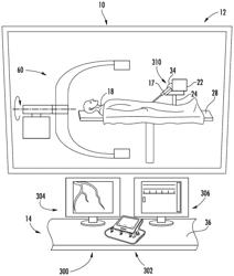 Remote catheter procedure system