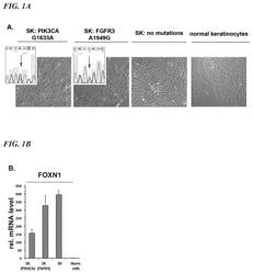 AGENTS AND METHODS FOR TREATING AND PREVENTING SEBORRHEIC KERATOSIS