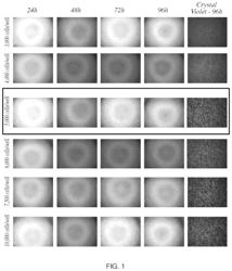 ASSAY FOR C5B-9 DEPOSITION IN COMPLEMENT-ASSOCIATED DISORDERS