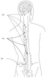 Systems and methods for utilizing model-based optimization of spinal cord stimulation parameters