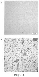 RECOMBINANT HUMAN ANTIBODIES FOR THERAPY AND PREVENTION OF POLYOMAVIRUS-RELATED DISEASES