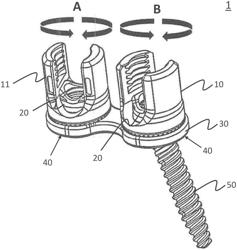 SPINAL ANCHORING SYSTEM