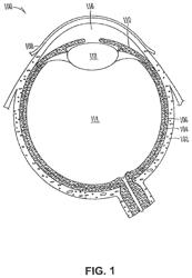 Ophthalmic drug sustained release formulation and uses thereof