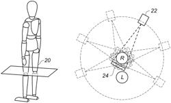 Patient position monitoring system based on 3D surface acquisition technique