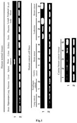 Pharmaceutical composition for treatment and prevention of cancer