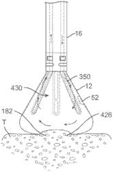 Visual electrode ablation systems