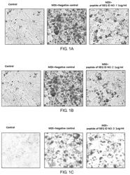 Peptide with anti-obesity and anti-diabetes activity and use thereof