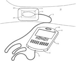 Apparatus and methods for controlling tissue oxygenation for wound healing and promoting tissue viability