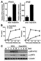 Use of inactivated nonreplicating modified vaccinia virus Ankara (MVA) as monoimmunotherapy or in combination with immune checkpoint blocking agents for solid tumors