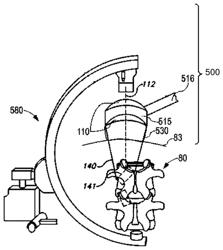 Handheld devices for projecting focused ultrasound and related methods