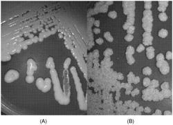 VARIANT OF OLEAGINOUS YEAST AND ITS USE FOR THE PRODUCTION OF LIPIDS