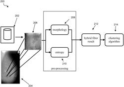 Breast cancer detection