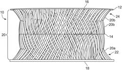 Load sustaining bone scaffolds for spinal fusion utilizing hyperbolic struts and translational strength gradients