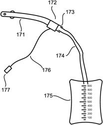 Measuring apparatus system and method