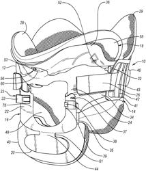 Cervical collar