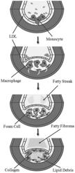 ENABLING CHOLESTEROL CATABOLISM IN HUMAN CELLS