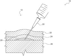 METHOD OF RESHAPING A BODY PART