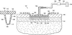 Epithelialization methods, dressings, and systems