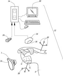 Determining implantation configuration for a prosthetic component or application of a resurfacing tool